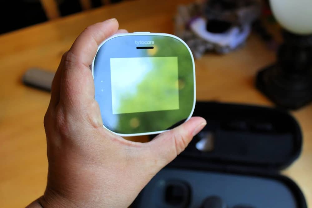 TytoHome Device